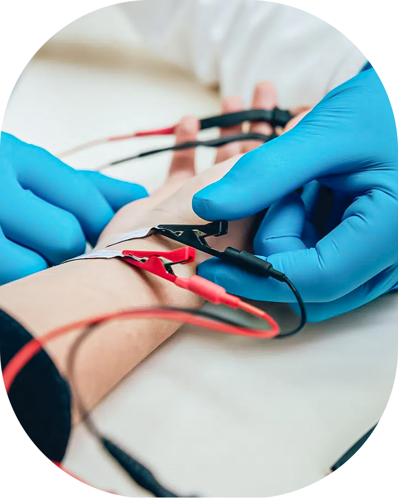 electromiograma